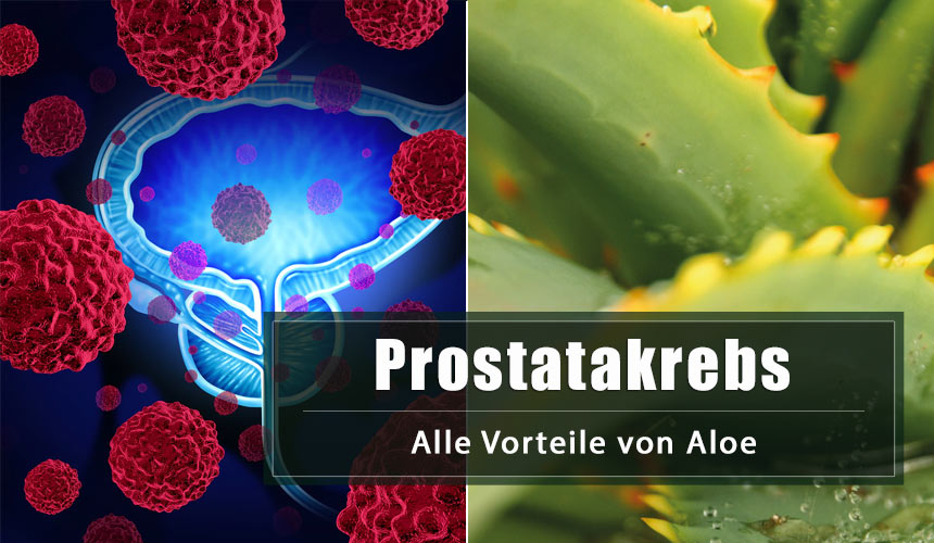 Prostatakrebs: die Vorteile von Aloe
