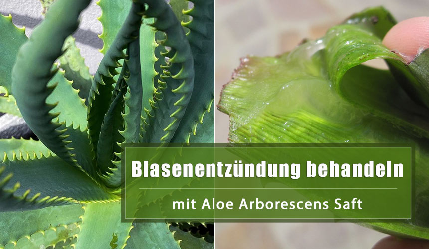 Wie man Blasenentzündung mit Aloe Arborescens heilt